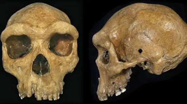 Доисторический череп Брокен-Хилл или Кабве из музея в Ливингстоне, Замбия, с видимым пулевым отверстием слева. 