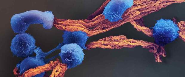 Ученые успешно заблокировали источник истощения иммунных клеток