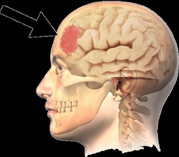 Сон что происходит с мозгом. Этисона. Что происходит когда бьют по голове с мозгом.