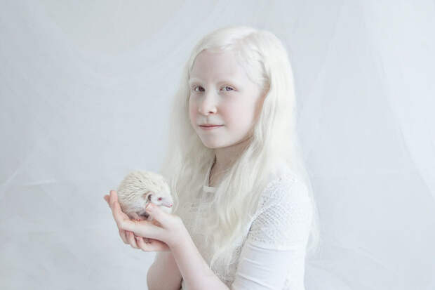 Шира альбиносы, красота, люди, фото, фотограф, фотопроект, цвет кожи