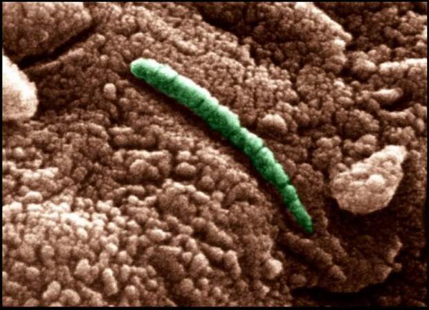 ALH84001-fossilised-nanobaceria-in-false-colours