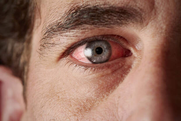 Nutrients: полифенолы растений могут замедлить развитие катаракты