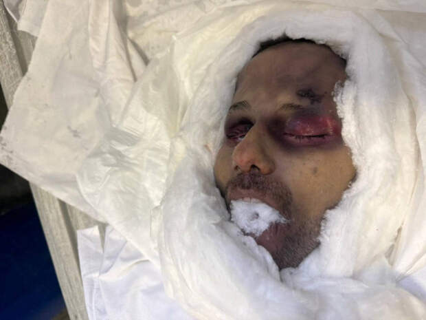 photo_2025-10-19_01-46-10 мертвый Абакар Абакаров