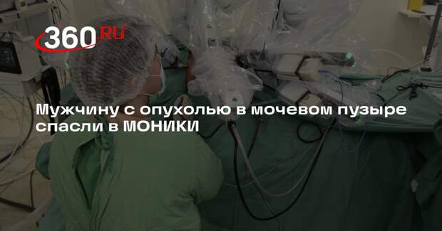 Мужчину с опухолью в мочевом пузыре спасли в МОНИКИ