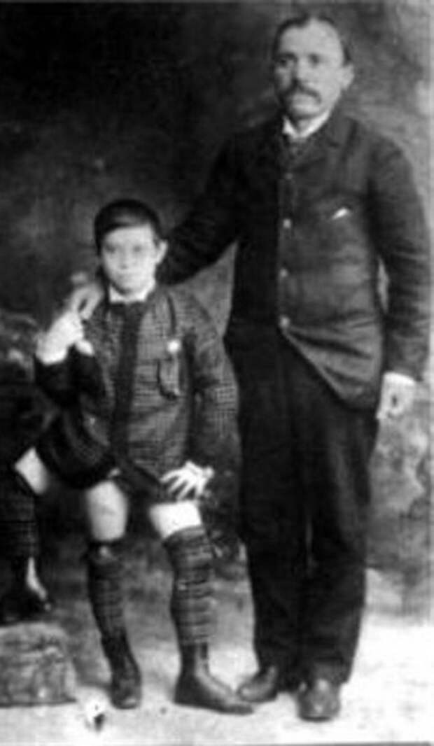 Фрэнк Лентини - человек, рожденный с тремя ногами Фрэнк Лентини - человек, рожденный с тремя ногами