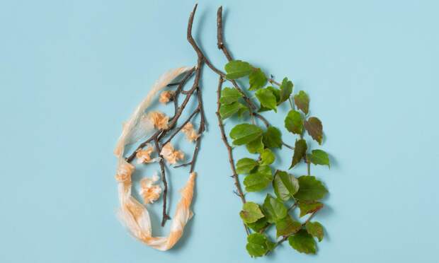 Почему после прививки заболевают туберкулезом — и еще 5 вопросов врачу о самой коварной болезни легких