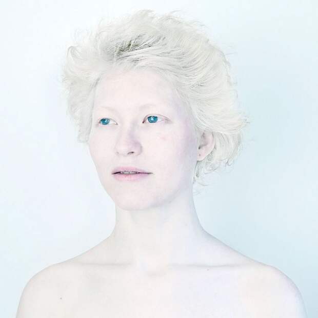 Гипнотизирующая и удивительная красота людей-альбиносов альбинос, красота, люди