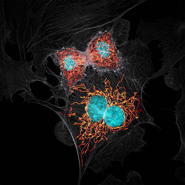 Работы с конкурса микрофотографии Nikon Small World 2019