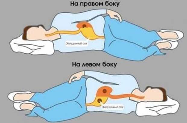 Почему нужно спать на левом боку: 7 причин