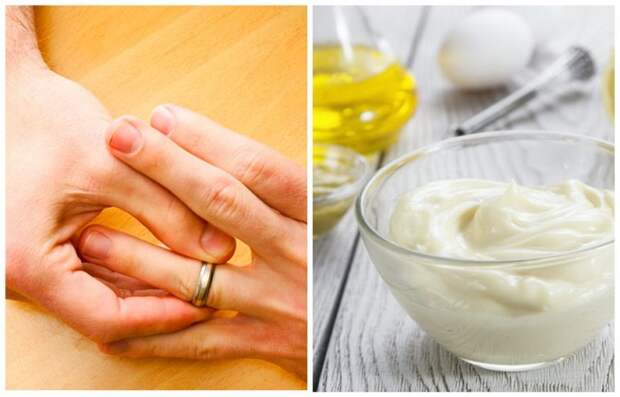 При помощи майонеза можно снять кольцо с пальца При помощи майонеза можно снять кольцо с пальца