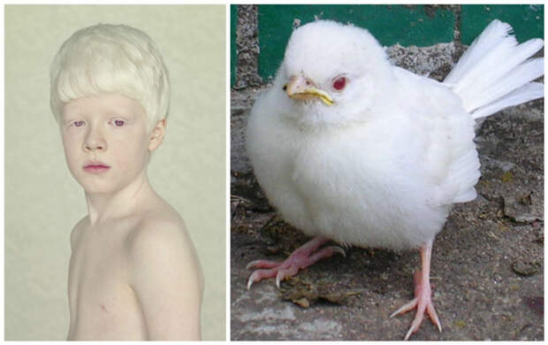 Глазной альбинизм: при нем поражаются только глаза. альбиносы, интересное, природа