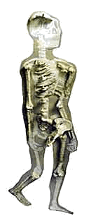 История попы.