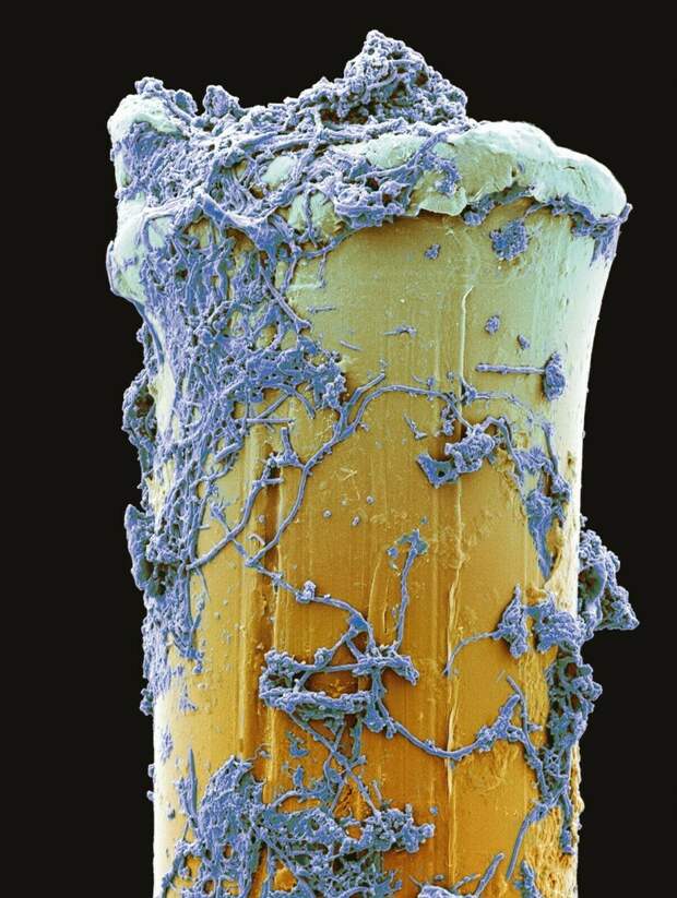 17 микрофотографий, которые покажут с новой стороны мир, что кроется у нас под носом