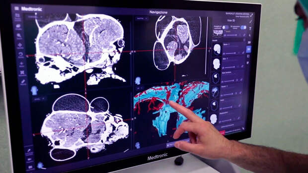 ChildDev: у близнецов чаще возникают задержки в развитии в раннем возрасте