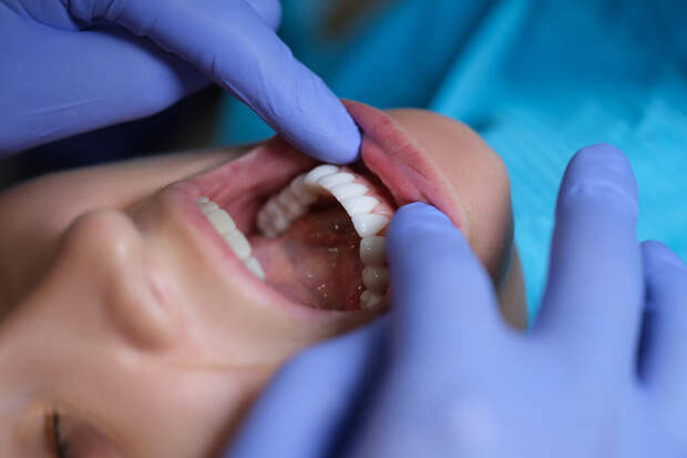 Врач Лысенков: гипоплазия и гиперплазия эмали могут приводить к пятнам на зубах