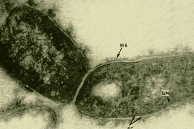 Врач Русакова: во внешней среде микобактерия туберкулеза живет более одного года