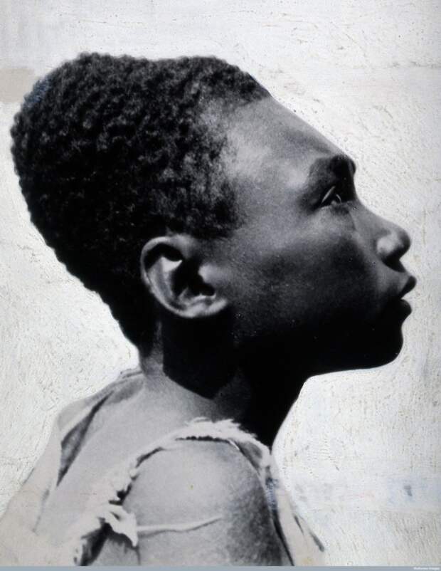 Мужчина с острова Бугенвиль. Папуа-Новая Гвинея, 1919 год. | Фото: ru.wikipedia.org.
