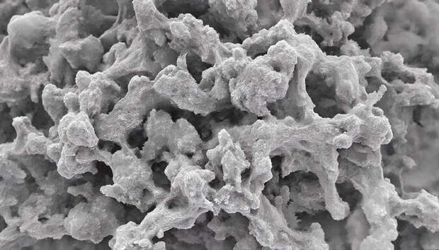 Ученые нашли простой способ снизить "плохой" холестерин с помощью одного продукта