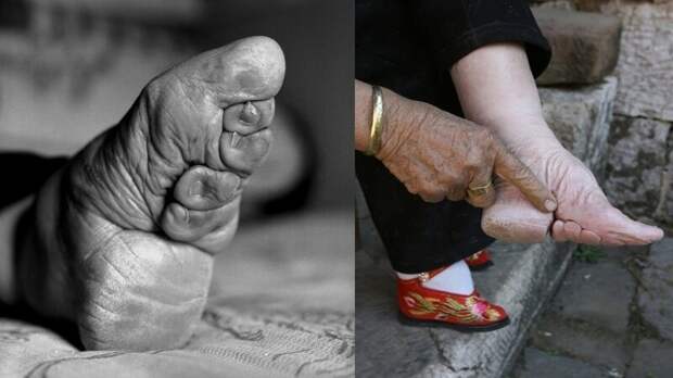 Не для слабонервных: в Китае была в 10 веке традиция бинтования ног девочкам. ведь считалось, что чем меньше нога - тем ее владелица благороднее