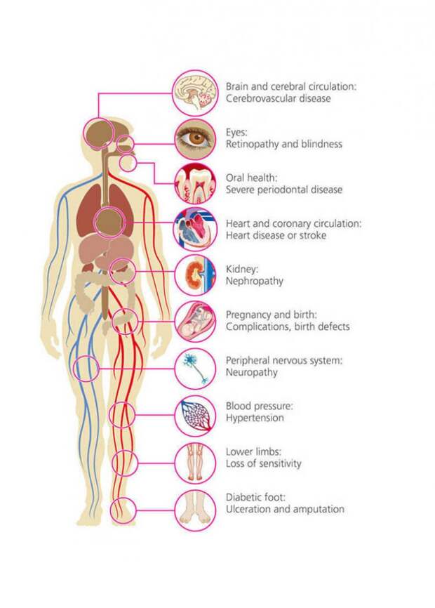 Советы, которые помогут вылечить диабет 2 типа