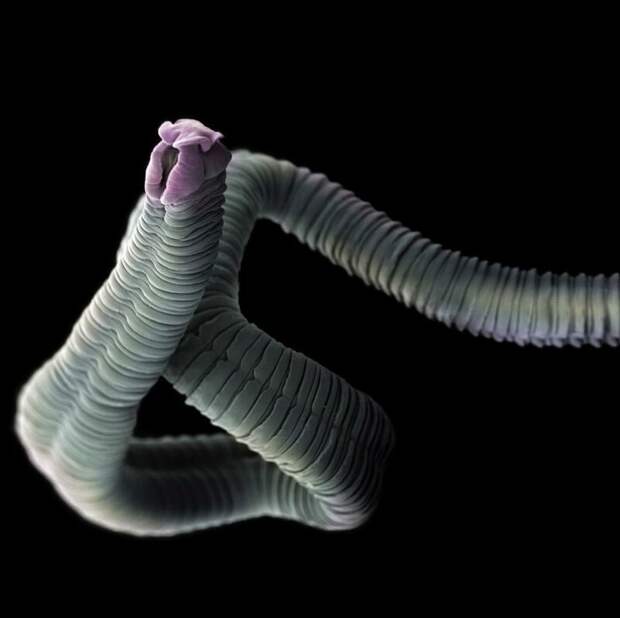 Ленточный червь (Eubothrium crassum) жизнь, интересно, под микроскопом, познавательно, фотограф