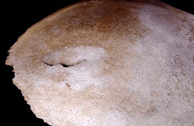 Фрагмент черепа со следами удара "тупым круглым предметом"