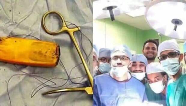 Египетские врачи достали из кишечника пациента мобильник, который находился там полгода