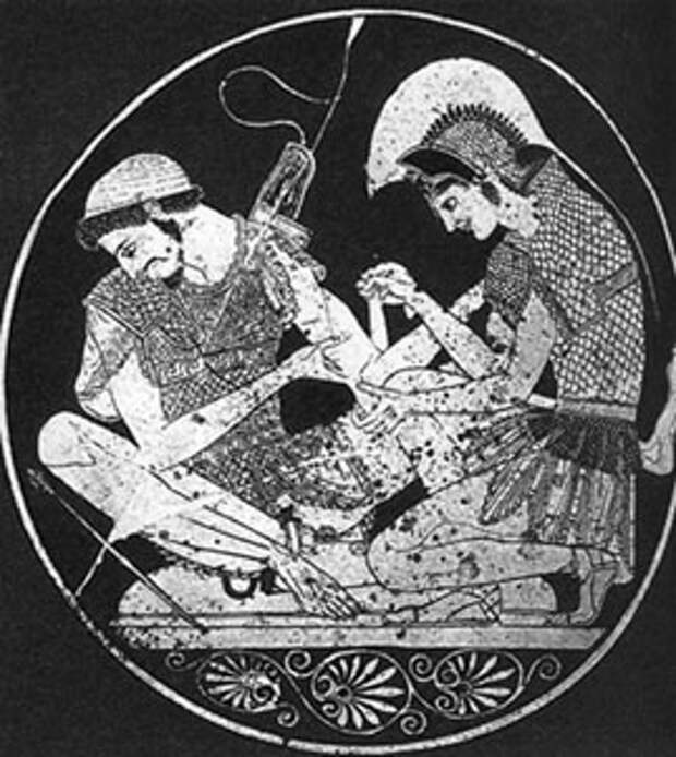 Ахилл перевязывает руку раненого Патрокла. Роспись на дне краснофигурного килика Сосия. Ок. 500 до н. э.