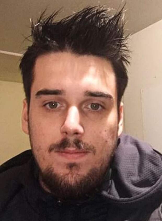 Выстрелившему себе в подбородок суициднику досталось лицо 23-летнего парня