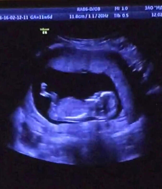 Алсу впервые показала младшего сына в младенчестве