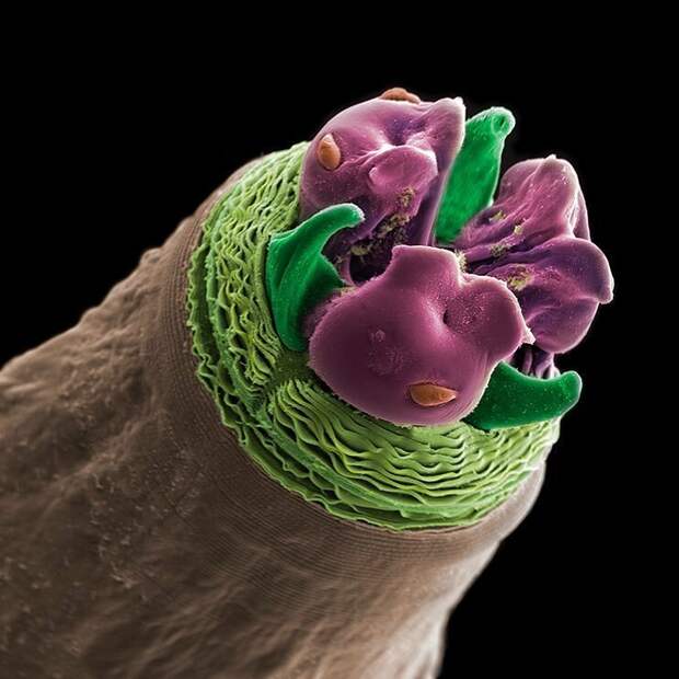 Нематода Contracaecum rudolphii жизнь, интересно, под микроскопом, познавательно, фотограф