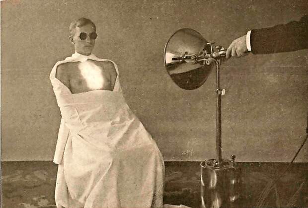 Eine künstliche Sonne gegen alles: Anfang des 20. Jahrhunderts war die Blütezeit der Lichttherapien. 