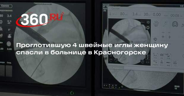 Проглотившую 4 швейные иглы женщину спасли в больнице в Красногорске