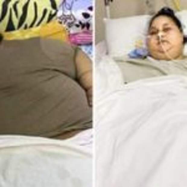 Самая тяжелая женщина в мире за два месяца скинула 242 кг