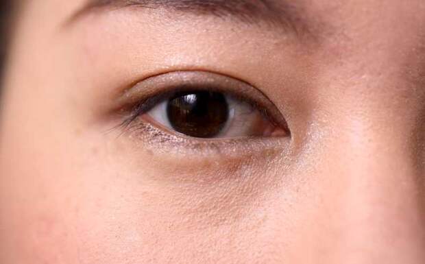 Выявлены варианты генов малых РНК, являющиеся причиной пигментного ретинита