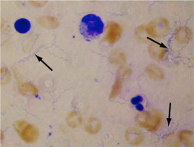 Боррелии (Borrelia)