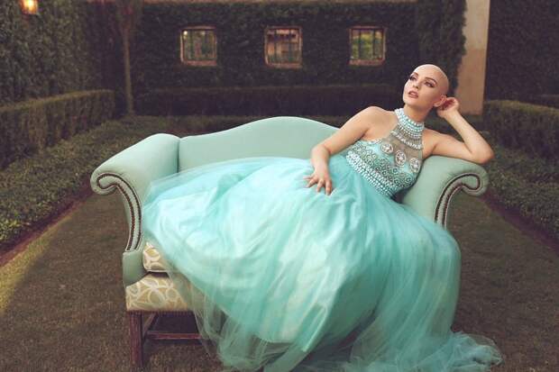 Фотомодель с лимфомой Ходжкина: по-прежнему принцесса, несмотря на рак девушка, заболевание, преодоление себя, рак, фотографии