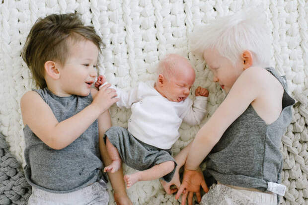 Мама родила двух детей-альбиносов и не могла поверить своему счастью