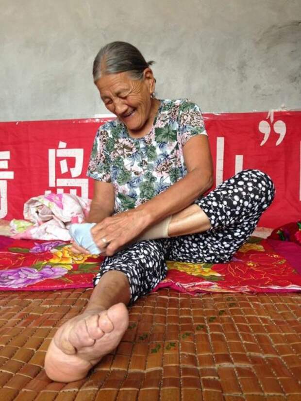 Жертвы китайской красоты, которые обладают удивительно маленькими ножками. /Фото: interesnoznat.com