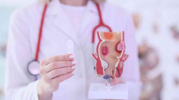 Prolapsed Hemorrhoids: Everything You Need to Know