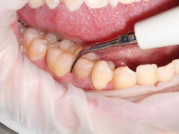 3 ошибки во время чистки зубов, которые портят вашу улыбку