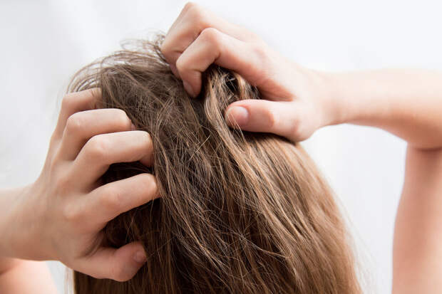 Врач Калюжин: расчесывание прыщиков на голове может привести к замедлению роста волос