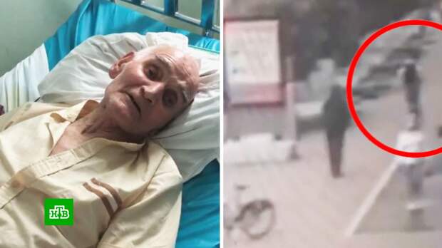 Уфимские самокатчики сломали 84-летнему старику шейку бедра