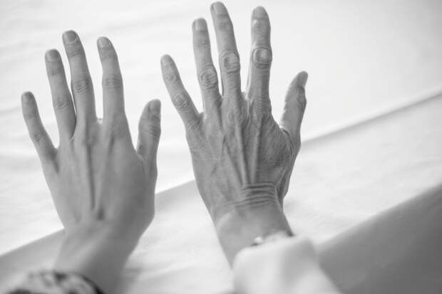 Руки больше не выдадут настоящий возраст: специалист рассказал, как омолодить кожу