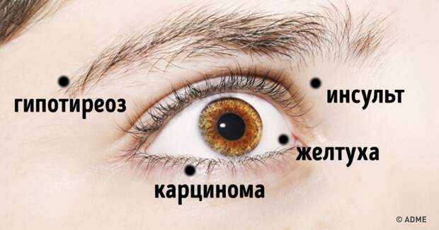 8 вещей, которые глаза пытаются сказать о вашем здоровье