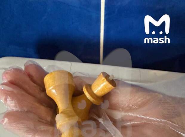 В Уфе врачи спасли мужчину с шахматными фигурами в заднем проходе