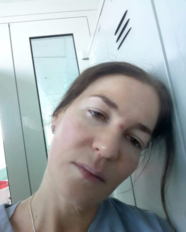 «Пациент с тобой разговаривает, а легких у него уже нет». Врач из Филатовской — о больных коронавирусом и сменах без перерыва