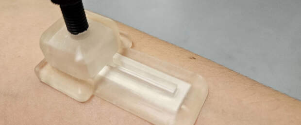 Традиционный забор крови может заменить безболезненный пластырь с микроиглами