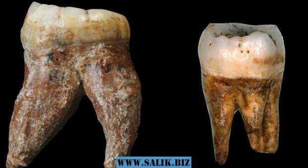 13 тыс. лет назад на Земле работали дантисты!