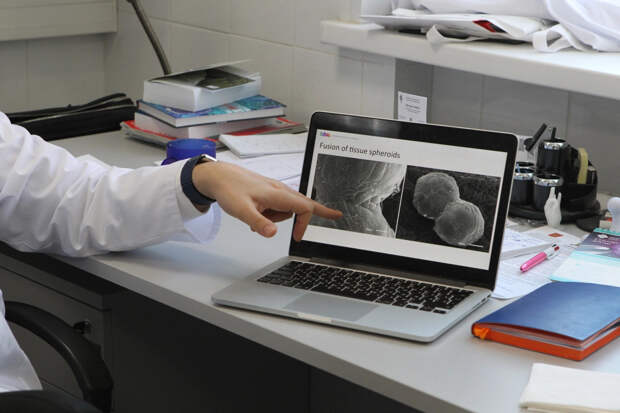 Ученые совершили новый прорыв в лечении артроза